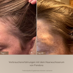 Fendora hårväxtprodukt