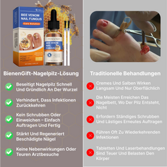 Stoppa nagelsvamp och skam på bara 7 dagar – biviftserumet för rena, fräscha naglar.